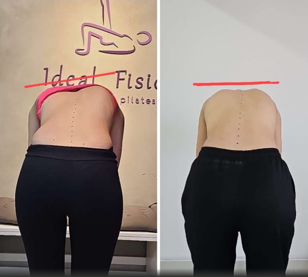 Adolescente postural